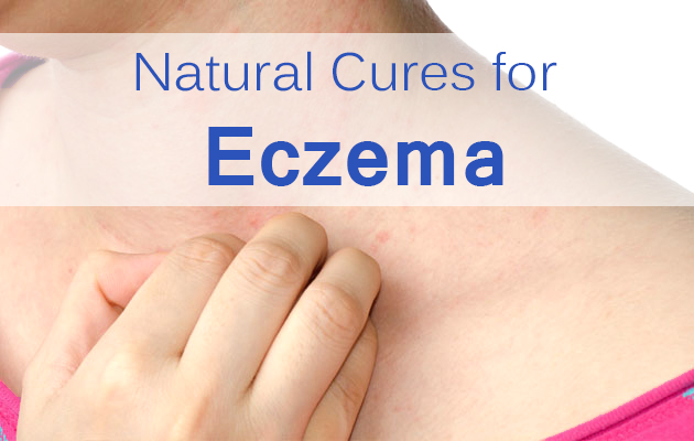 Natural Cures for Eczema